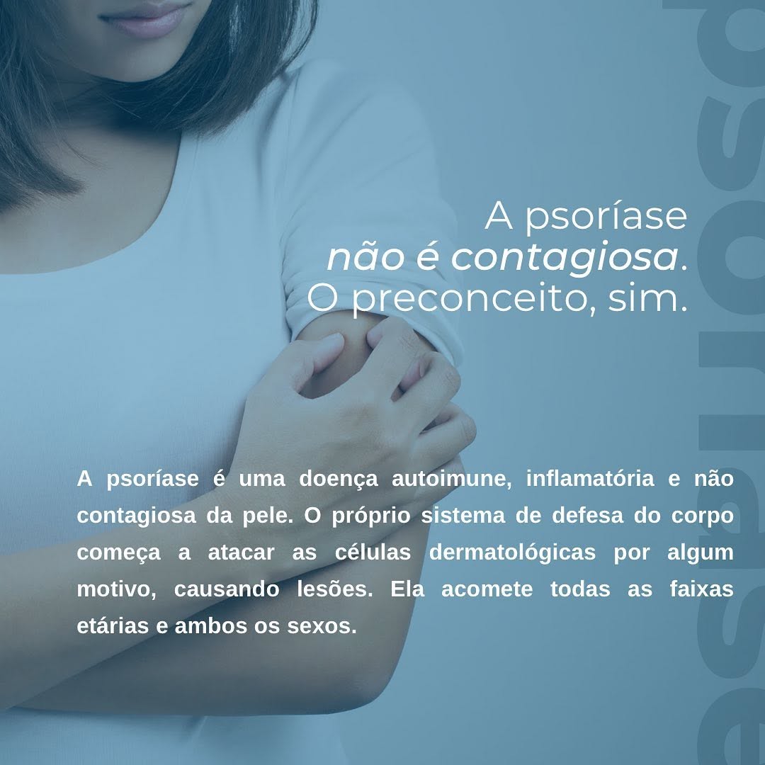 ❗️A psoríase gera lesões na pele e até complicações no interior do corpo. Ela não tem cura nem prevenção, mas o tratamento evoluiu muito ao longo dos anos!