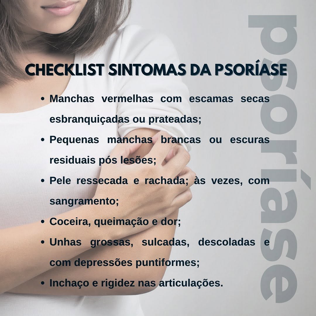 🔍 É importante estar atento aos sinais. Caso perceber qualquer um dos sintomas, procurar o dermatologista imediatamente. Quanto mais precoce for o diagnóstico, mais fácil será o tratamento.