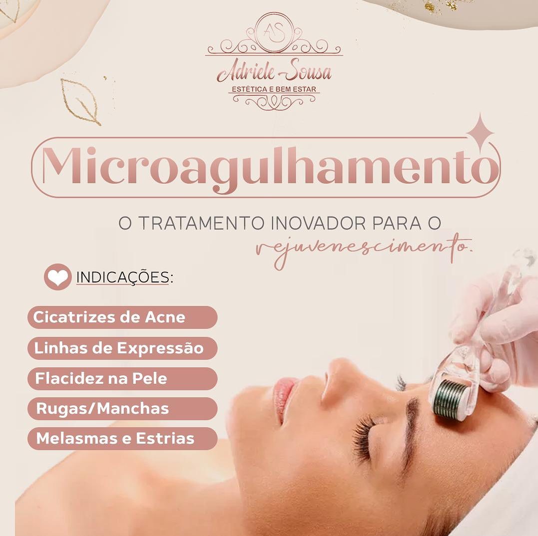 ▶️ Você já ouviu falar sobre o Microagulhamento? ✨

✨ Os benefícios são inúmeros e a técnica tem atraído a atenção das pessoas que desejam melhorar a pele através de procedimentos estéticos.

✨ O procedimento é indicado para homens e mulheres que desejam melhorar rugas, flacidez, cicatrizes de estrias e acnes. Queda capilar, queimaduras e cicatrizes hipertróficas também são outras indicações da técnica. 

▶️ O microagulhamento consiste na aplicação de agulhas feitas de aço cirúrgico ou titânio, 