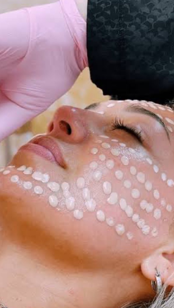 • Limpeza de pele profunda 
• Microagulhamento 
• Bbglow 

#estética #reels #viral #beleza