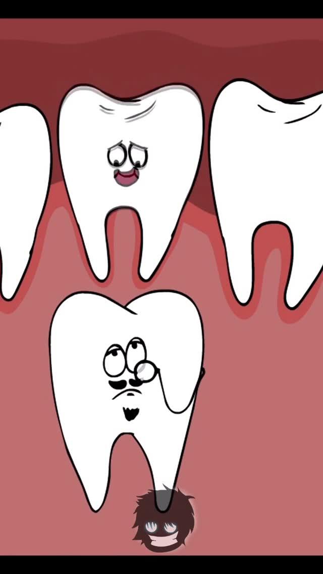 Dente de rico e dente de pobre #dente #pobre #ricorico #humor #viral