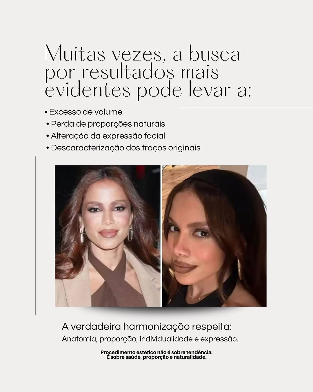 A toxina botulínica é amplamente utilizada para suavizar linhas de expressão.

Quando aplicada de forma adequada, pode proporcionar um resultado natural, preservando a mobilidade facial.

📌 Procedimento médico, com indicação individual.

Agende sua avaliação.