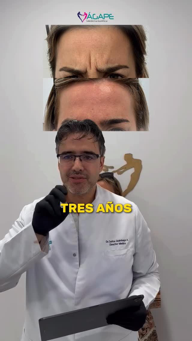 ✨ ¡DESCUBRE TRIÁGAPE! ✨
El tratamiento exclusivo de Centro Médico Ágape que combina tres tecnologías líderes para un rejuvenecimiento profundo, seguro y científicamente comprobado 💫

Hoy te presentamos testimonio real:
🔥 Rejuvenecimiento facial🔥
Para estimular colágeno, tensar la piel, mejora textura, cicatrices, poros y líneas finas desde la primera sesión 😍✨

Mira este caso real 📸➡️
Resultados visibles en solo 1 sesión 💕

Si buscas una piel más firme, lisa, joven y radiante…
✨ TRIÁGAPE e