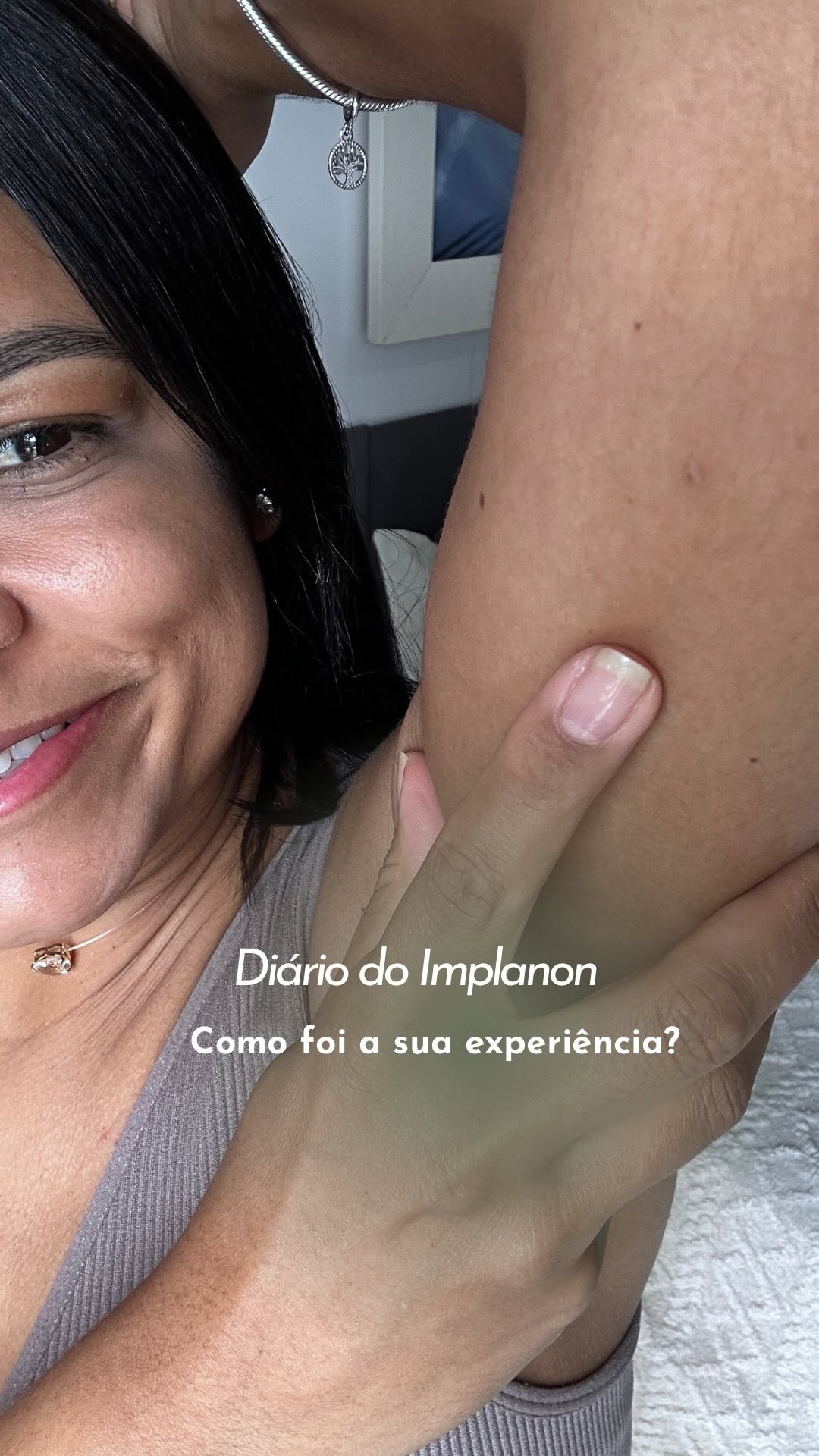 Depois que coloquei Implanon percebi que cada corpo reage de um jeito. 
Quero saber: qual foi a sua experiência?

#implanon #contraceptivo #saudefeminina #anticoncepcional #hormonios
