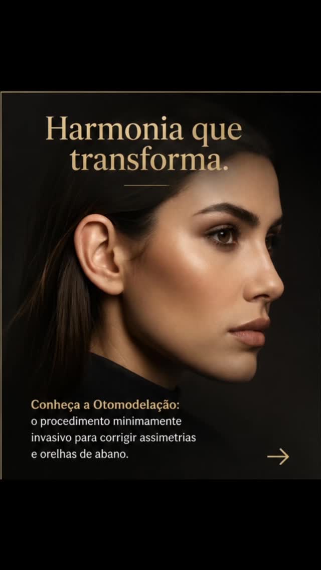 Orelhas em harmonia. Autoestima em evidência. 

A otomodelação é uma técnica minimamente invasiva capaz de corrigir a orelha de abano com naturalidade, precisão e elegância, sem cortes extensos e com downtime curto, permitindo retorno rápido à rotina.

Mais do que transformar a estética, ela resgata a liberdade de prender os cabelos, sorrir sem inseguranças e se olhar no espelho com confiança.
Porque pequenos detalhes podem mudar completamente a forma como você se sente consigo mesmo.

Agende su