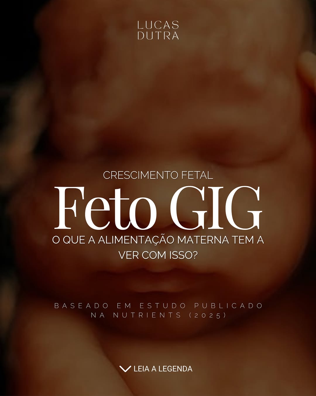 FETO GIG:
o que a alimentação materna pode influenciar no crescimento do bebê?

Um estudo científico publicado em 2025 na revista Nutrients mostrou que maior consumo energético e desequilíbrio de macronutrientes aumentaram o risco de bebês GIG, principalmente em gestantes com sobrepeso, obesidade e diabetes gestacional.

O crescimento fetal não depende apenas da genética.
O ambiente metabólico da mãe também influencia diretamente o desenvolvimento do bebê.

Dietas com excesso de carboidratos ref