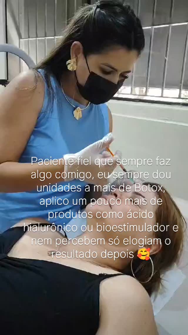 Cliente fiel sente a diferença… mesmo quando não percebe os detalhes 👀✨

Quem cuida da pele comigo sabe que eu não entrego apenas procedimento.

Entrego estratégia, naturalidade e resultado. 💉🤍

Às vezes vai algumas unidades a mais de Botox, um toque extra de ácido hialurônico ou aquele bioestimulador pensado exatamente para potencializar o resultado… 

e o melhor: elas só percebem que estão ainda mais lindas quando começam os elogios 😌✨

Porque estética de verdade não é exagero.

É saber o 