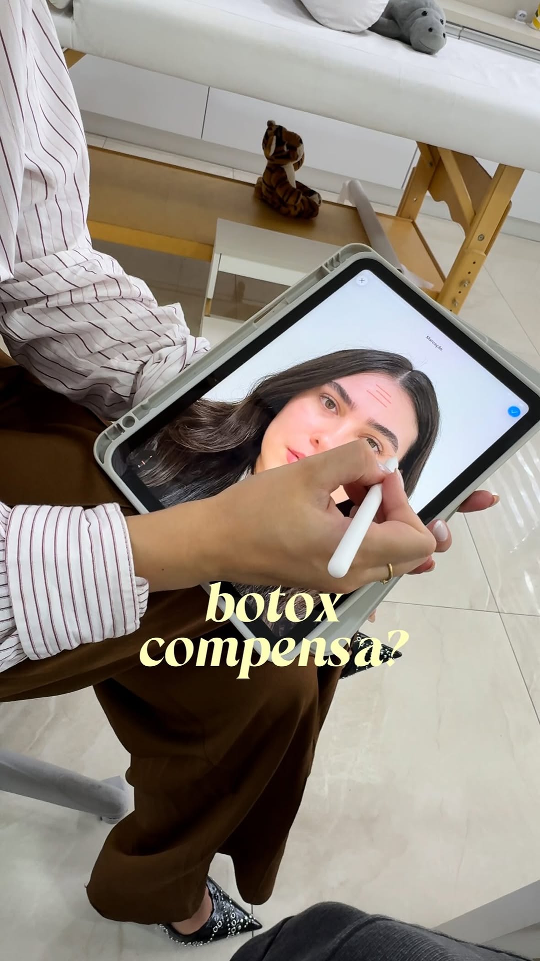 03 meses do meu primeiro botox 🥳

Já quero voltar @drabarbara.y