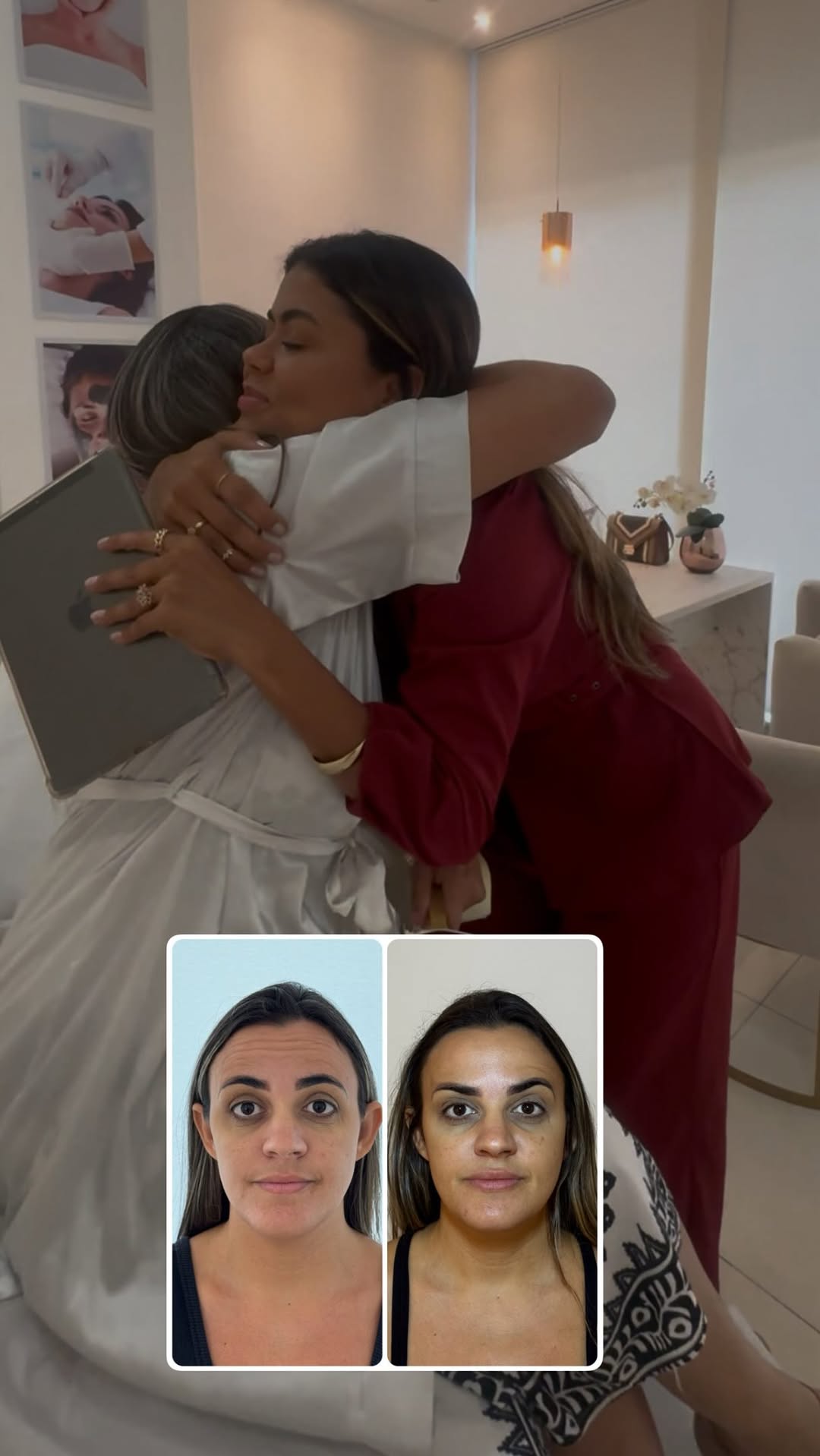 Existem resultados que vão muito além do espelho.

Hoje recebi esse carinho de uma paciente que ainda está em processo, construindo sua melhor versão passo a passo. E ouvir suas palavras me lembrou o quanto cada transformação carrega uma história, expectativas, confiança e entrega.

Sou profundamente grata pela confiança que cada paciente deposita em minhas mãos e no meu trabalho. Nada é mais especial do que acompanhar essa jornada e ver a autoestima florescendo de forma natural e verdadeira.

A