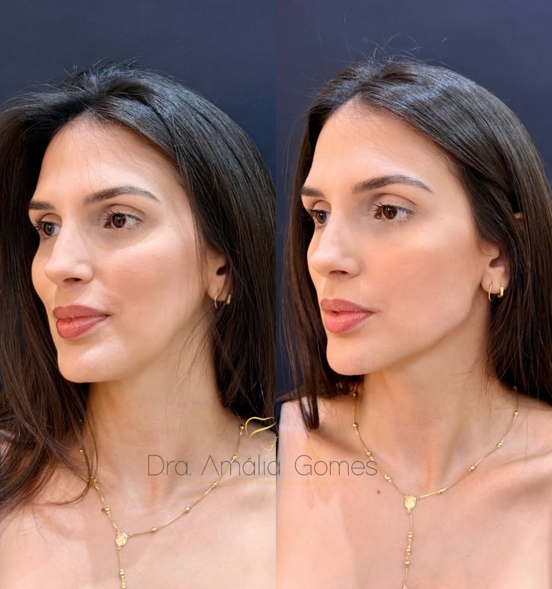 Sutileza é quando as pessoas percebem que você está mais bonita, mas não sabem exatamente por quê. ✨