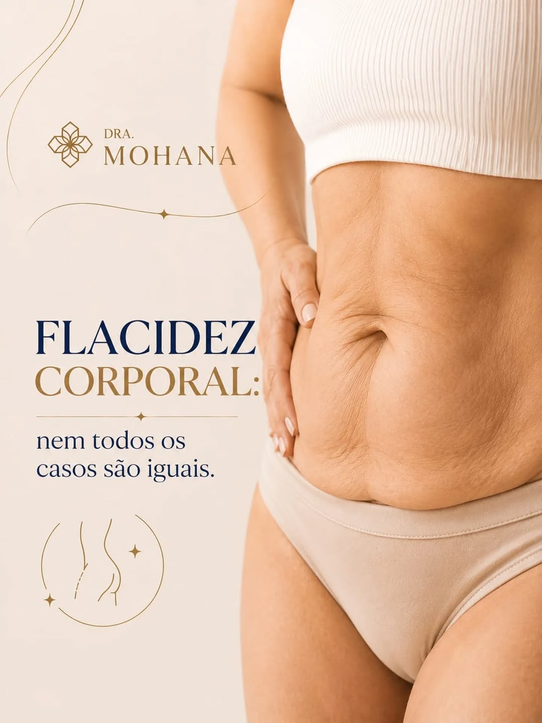 Flacidez corporal: nem todos os casos são iguais.
A flacidez corporal pode estar relacionada a diferentes fatores, como envelhecimento natural, redução da produção de colágeno, alterações de peso, gestação e características individuais da pele.

Por isso, não existe uma única abordagem que seja adequada para todos os pacientes.
Antes de pensar em qualquer tratamento, é fundamental compreender a causa da flacidez e realizar uma avaliação médica criteriosa para identificar as necessidades de cada 
