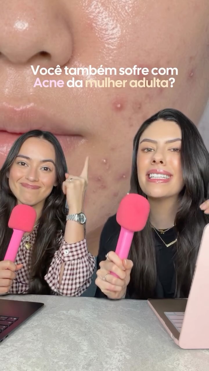 Se vc tem entre 20 e 30 poucos anos e tá sofrendo com acne sem saber mais o que fazer, assiste esse vídeo 🤝🏻 mais alguma glowzinha sofrendo com isso? 😩 #acne #espinhas #peleoleosa #hormonios #acnehormonal