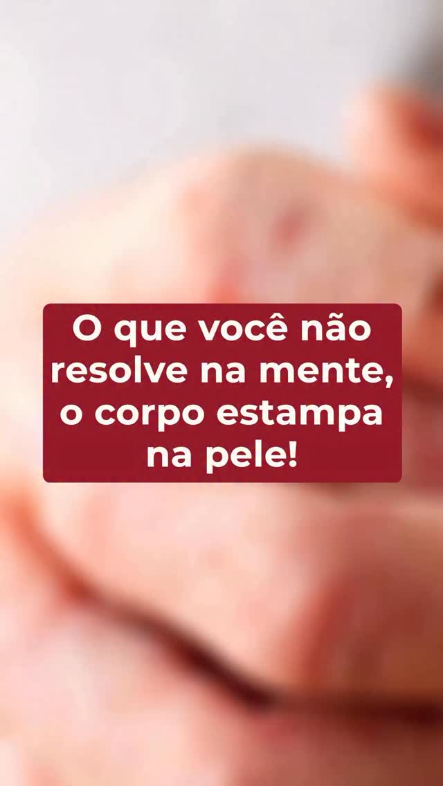 Ao longo dos anos, acompanhando clientes e estudando a pele, percebi algo que se repete com frequência 👇🏻

Momentos de estresse intenso, ansiedade, sobrecarga emocional ou exaustão, costumam caminhar junto com crises de diversas condições da pele.

Psoríase.
Dermatite.
Disidrose.
Vitiligo.
Alopécia Areata.
Queda capilar.

Isso não significa que essas doenças sejam “emocionais” ou que existam apenas por causa da mente. Mas significa que a pele e as emoções estão profundamente conectadas.

Por i