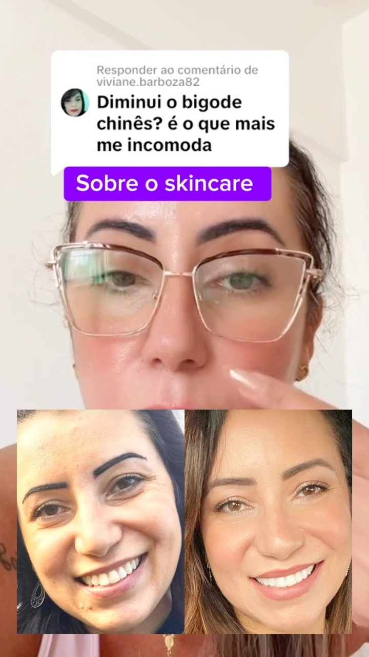 O bigode chinês e os pés de galinha te incomodam? 👵🏼❌

Com o passar dos anos, a produção de colágeno no nosso corpo despenca, e é aí que a flacidez e as linhas de expressão começam a marcar mais o rosto. 

Mas a boa notícia é que dá para devolver a firmeza e o viço da pele em casa!

O segredo está em cuidar de dentro para fora e de fora para dentro com os produtos certos.

✨ Como funciona:
Por dentro: Apenas 2 cápsulas ao dia do nosso suplemento (uma de manhã e outra à noite) para repor o colá